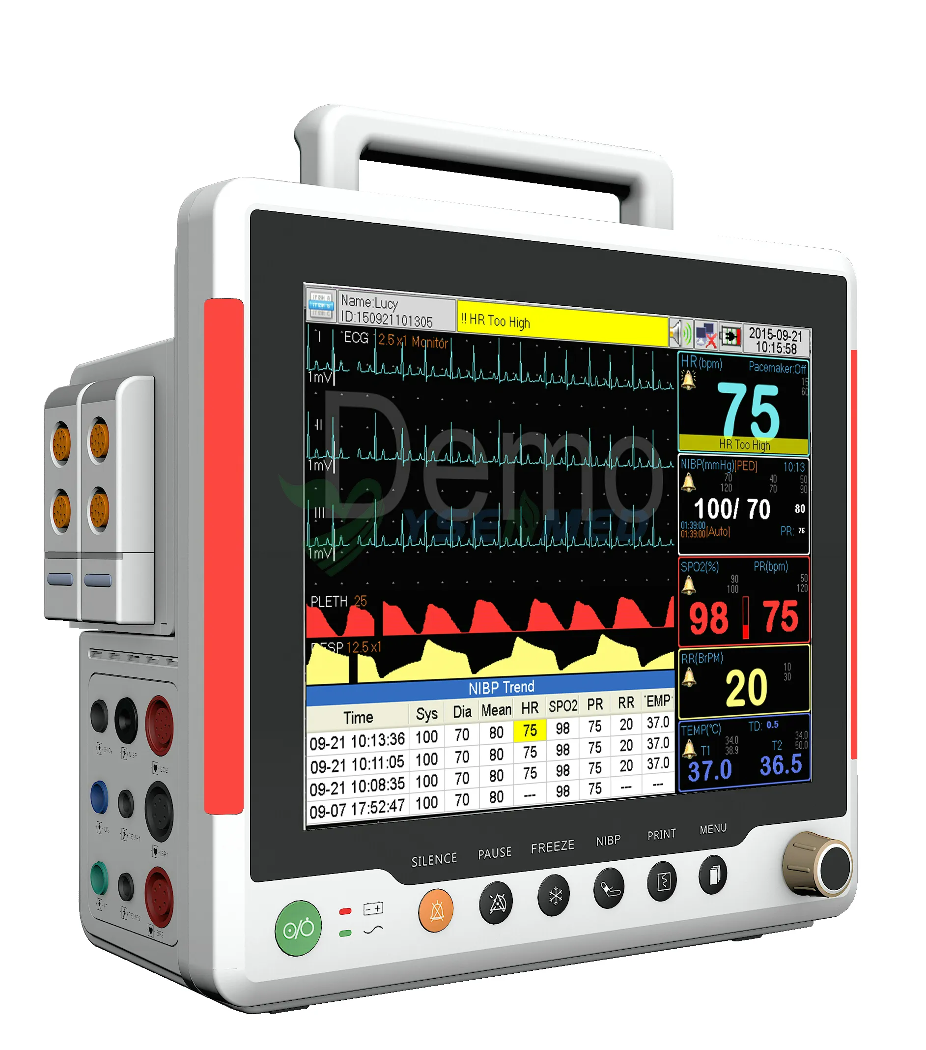 12.1" Multi-Parameter Patient Monitor
