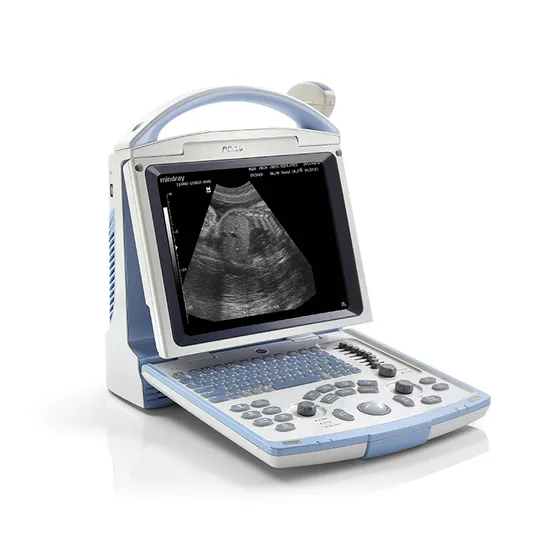 Mindray DP-10 Ultrasound Machine